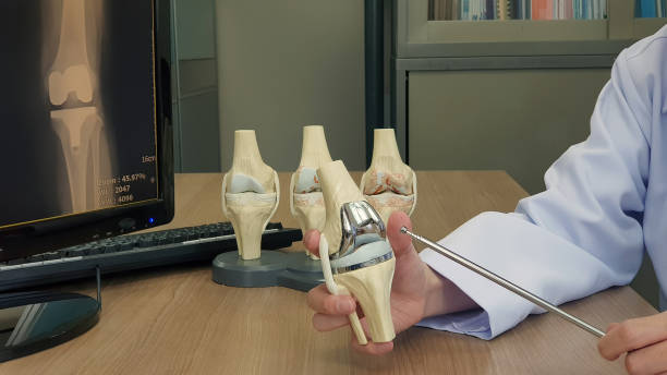 Knee Prosthesis Surgery Process