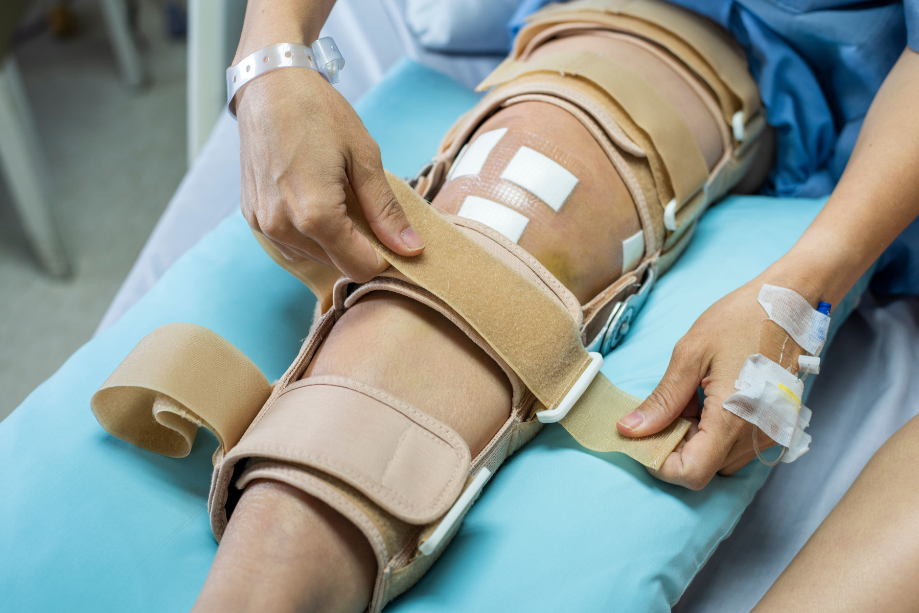 Robotik Diz Protezi Ameliyatı Nedir?