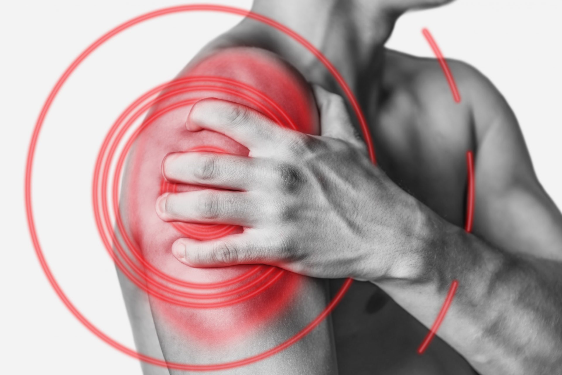 What is Shoulder Dislocation?