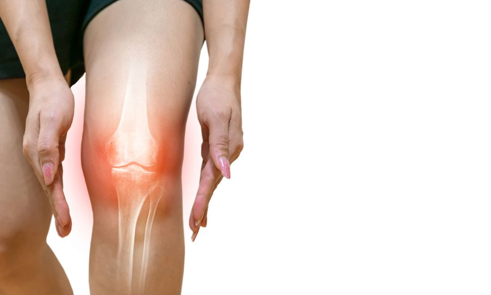 Osteoartrit