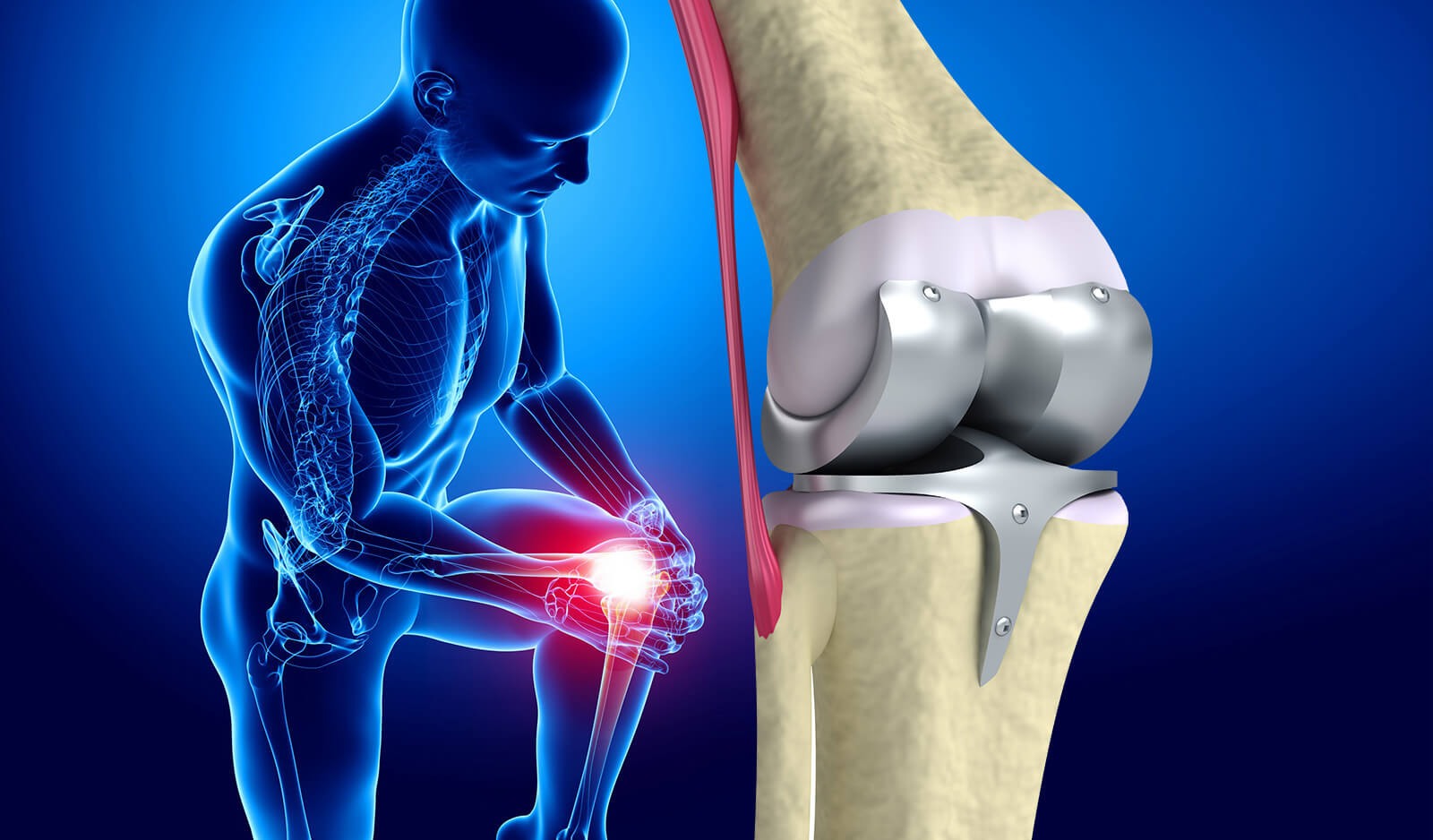 Knee Calcification in Young People