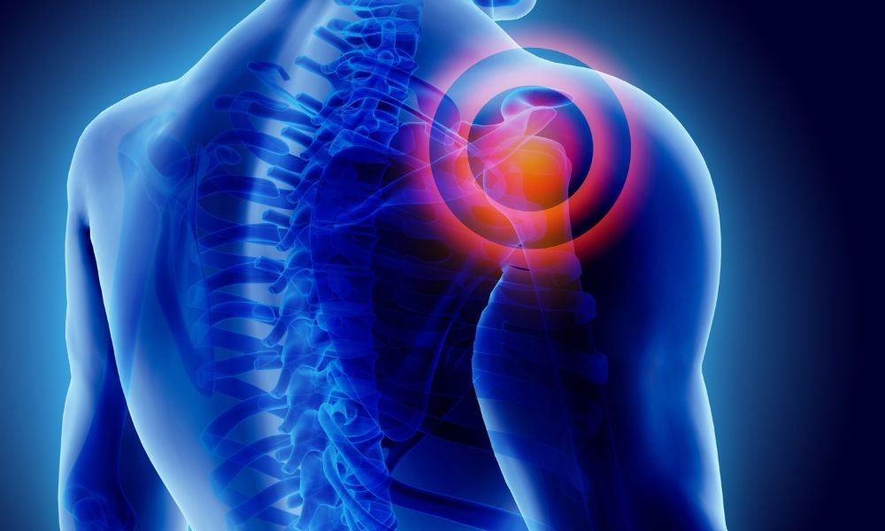 Shoulder Fracture