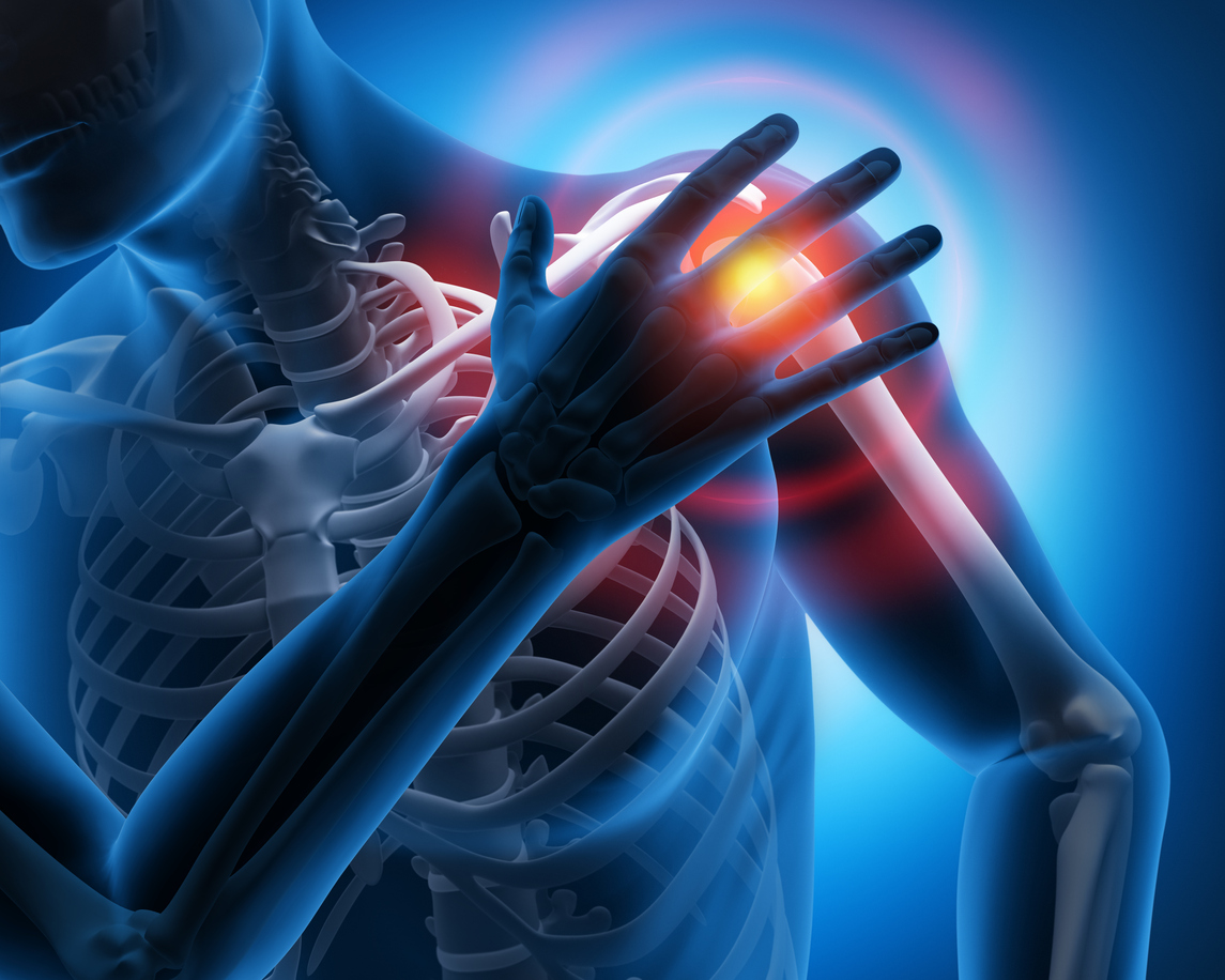 Shoulder Calcification in the Elderly