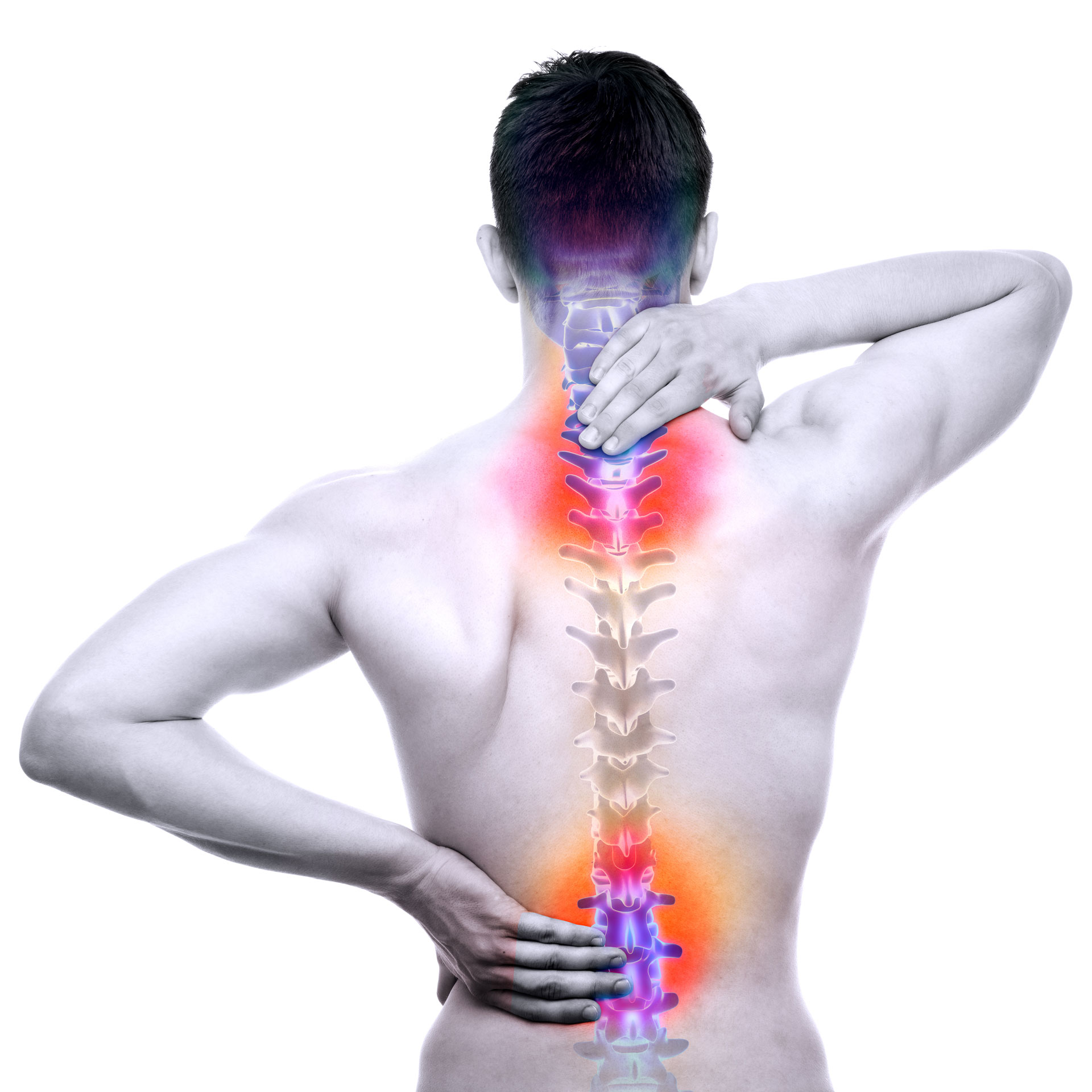 Boyun Fıtığı Nedir? 