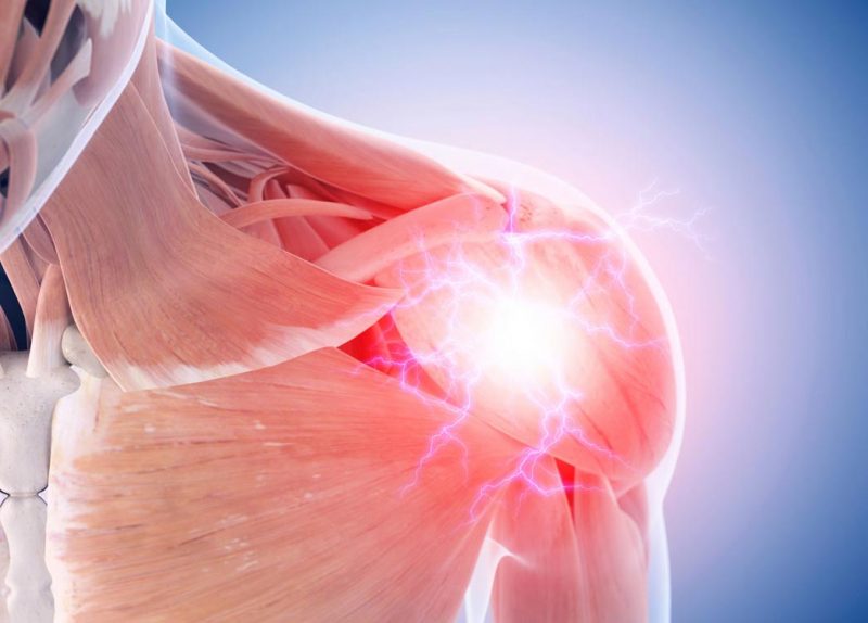 Omuz Labrum Yırtığı