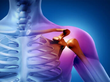 Osteoartrit Tedavisi
