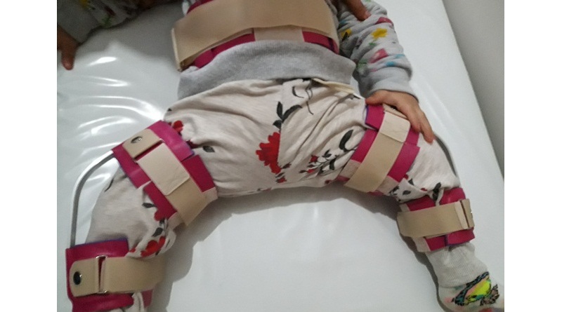 Doğuştan Kalça Çıkığı